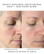 NYMPH NECTAR Superfruit Repair Balm: Sea Vitamin C: 15 ml