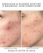 GLOW JUICE 10-Acid Refining Peel: Fruit AHA/BHA : 1 oz