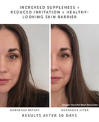 HORIZON Ceramide Repair Serum: Ceramide Complex