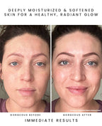 CALYPSO Antioxidant Glow Facial Oil: Sea Vitamin C + CoQ10
